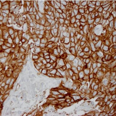 Anti-CD274 antibody [ZR3] {KLH} IHC antibody paraffin tissue