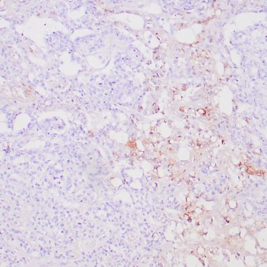 Anti-AFP antibody [C3] IHC antibody paraffin tissue