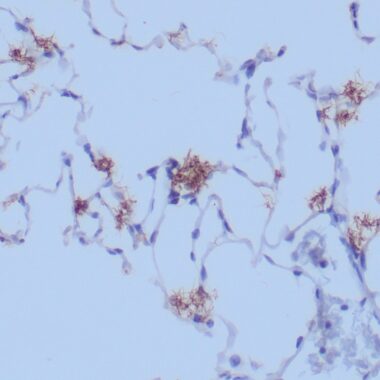 Anti-Treponema Pallidum antibody [Polyclonal] IHC antibody paraffin tissue