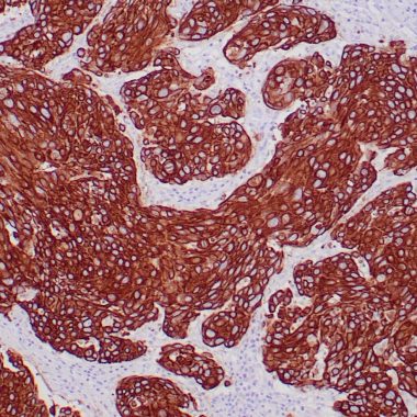 Anti-Pan-Keratin antibody [AE1/AE3] IHC antibody paraffin tissue