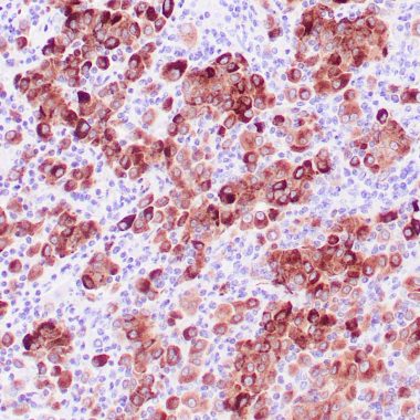 Anti-TYR antibody [T311] IHC antibody paraffin tissue