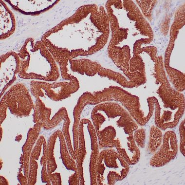 Anti-PSA antibody [ZR232] IHC antibody paraffin tissue