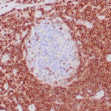 Anti-BCL-2 antibody (41-54aa) [ZR130] IHC antibody paraffin tissue