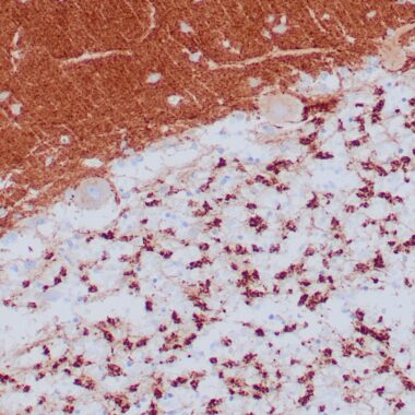 Anti-Synaptophysin antibody (224-313aa) [ZR445] IHC antibody paraffin tissue