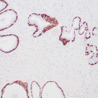 Anti-KRT14 antibody (C-Term) [LL002] IHC antibody paraffin tissue