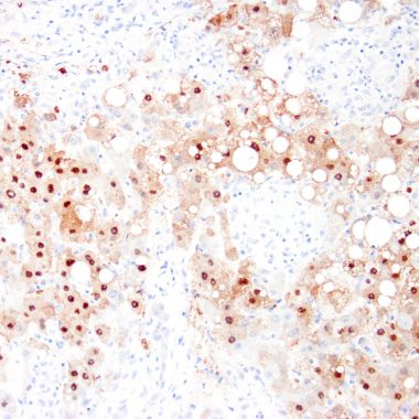 Anti-HBcAg antibody [Polyclonal] IHC antibody paraffin tissue