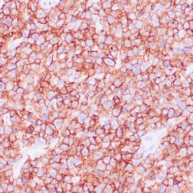 Anti-CD45/RB antibody [2B11/PD7‐26] IHC antibody paraffin tissue