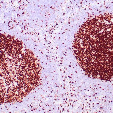 Anti-Recombinant-Ki-67 antibody (2293-2478aa) [ZM67] IHC antibody paraffin tissue
