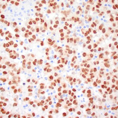Anti-MITF antibody (N-Term) [C5/D5] IHC antibody paraffin tissue