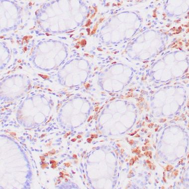 Anti-Recombinant-CD68 antibody [KP1] IHC antibody paraffin tissue