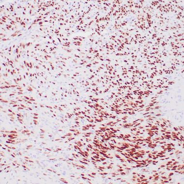 Anti-SOX10 antibody (115-269aa) [ZM10] IHC antibody paraffin tissue