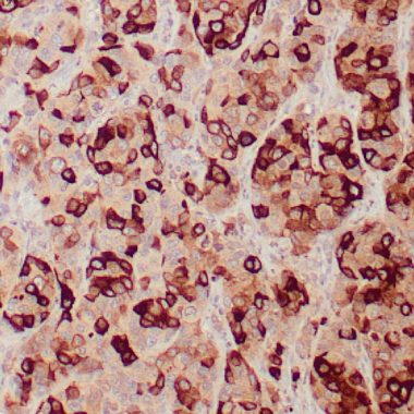 Anti-Mammaglobin Cocktail antibody (Full length) [304‐1A5&31‐A5] IHC antibody paraffin tissue