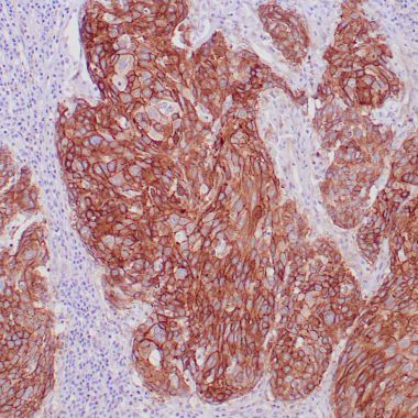 Anti-EGFR antibody (344-492aa) [ZR16] IHC antibody paraffin tissue