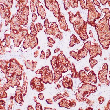 Anti-Recombinant-Synaptophysin antibody (200-300aa) [ZM208] IHC antibody paraffin tissue