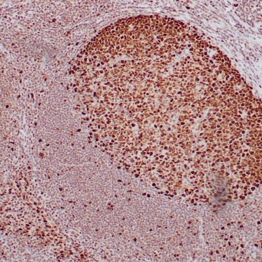 Anti-PCNA antibody (Full length) [ZR378] IHC antibody paraffin tissue
