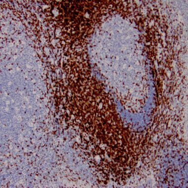 Anti-CD3 antibody (23-119) [ZR414] IHC antibody paraffin tissue