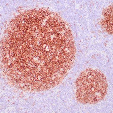 Anti-Recombinant-MS4A1 antibody [L26] IHC antibody paraffin tissue