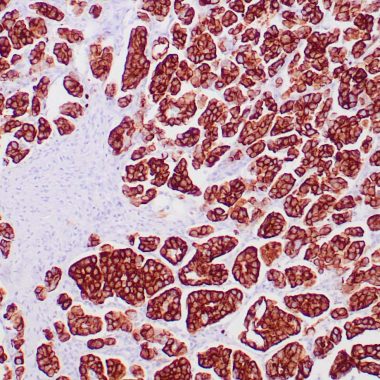 Anti-KRT7 antibody [OV‐TL‐12‐30] IHC antibody paraffin tissue