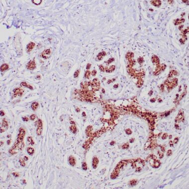 Anti-GATA3 antibody (Full length) [ZR358] IHC antibody paraffin tissue