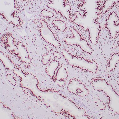 Anti-Androgen receptor antibody (1-100aa) [ZR334] IHC antibody paraffin tissue