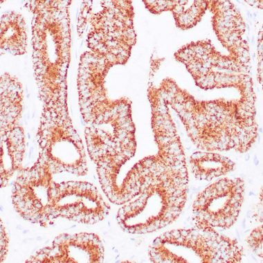 Anti-Recombinant-AMACR antibody [13H4] IHC antibody paraffin tissue