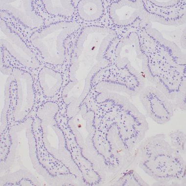 Anti-H. Pylori antibody [Polyclonal] IHC antibody paraffin tissue