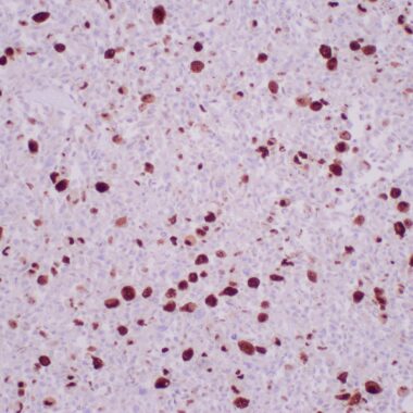 Anti-CMV antibody [ZR456] IHC antibody paraffin tissue