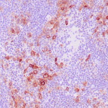 Anti-CD30 antibody [Ber‐H2] IHC antibody paraffin tissue