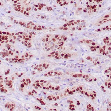 Anti-Recombinant-PGR antibody (412-526aa) [ZR4] IHC antibody paraffin tissue