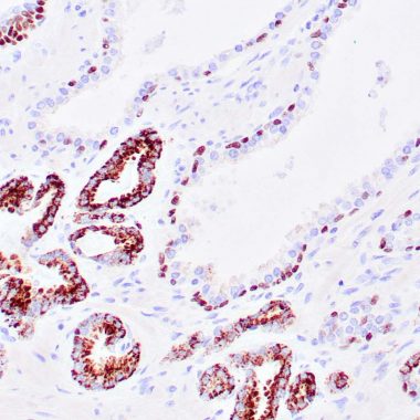 Anti-AMACR+p63 antibody [13H4+4A4] IHC antibody paraffin tissue