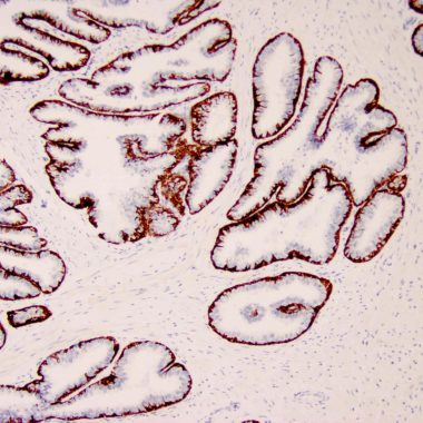 Anti-Keratin 5/6 antibody [D5‐16B4] IHC antibody paraffin tissue