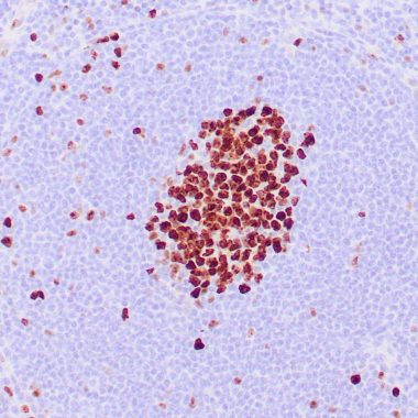 Anti-MKI67 antibody [MIB‐1] IHC antibody paraffin tissue