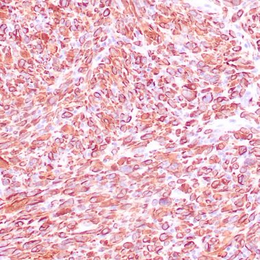 Anti-Desmin antibody [ZM34] IHC antibody paraffin tissue