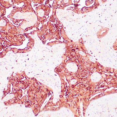 Anti-Recombinant-Napsin A antibody [ZM11] IHC antibody paraffin tissue