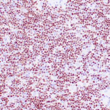 Anti-Recombinant-TdT antibody (52-192aa) [ZM51] IHC antibody paraffin tissue