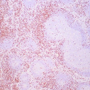 Anti-Recombinant-CD8 antibody [ZM54] IHC antibody paraffin tissue