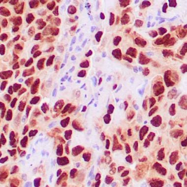 Anti-TTF-1/NKX2.1 antibody [ZR176] IHC antibody paraffin tissue