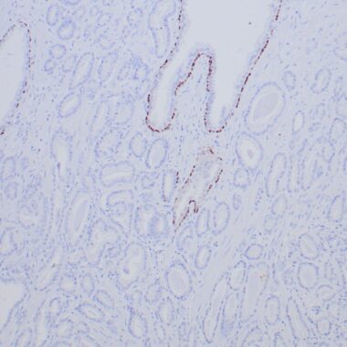 Anti-p63 antibody (C-Term) [ZR439] IHC antibody paraffin tissue