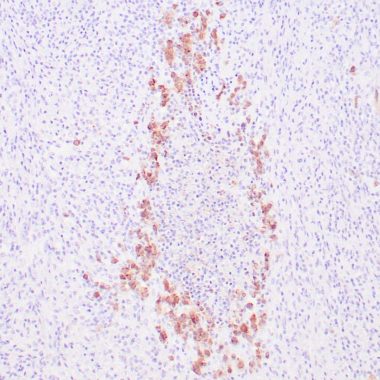 Anti-EBV-LMP antibody [CS1-4] IHC antibody paraffin tissue