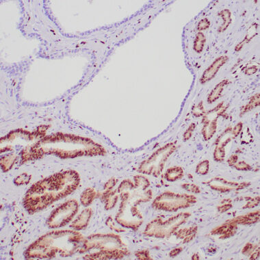 Anti-ERG antibody (450-C-Term) [ZR331] IHC antibody paraffin tissue