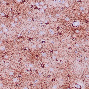 Anti-GFAP antibody (150-250aa) [ZR356] IHC antibody paraffin tissue