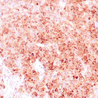 Anti-INHA antibody (1-32aa) [R1] IHC antibody paraffin tissue