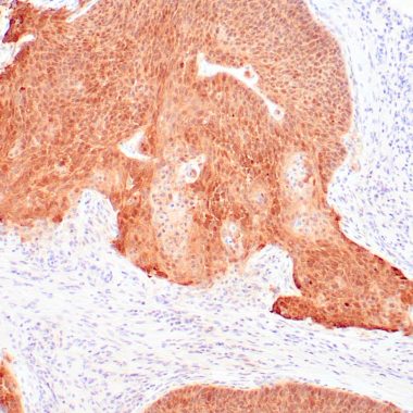 Anti-P16INK4a antibody (C-Term) [G175‐405] IHC antibody paraffin tissue