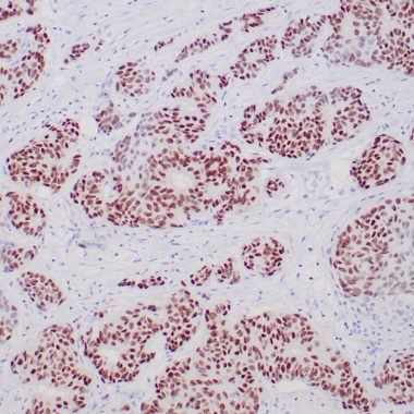Anti-ER antibody (495-595aa) [ZR147] IHC antibody paraffin tissue