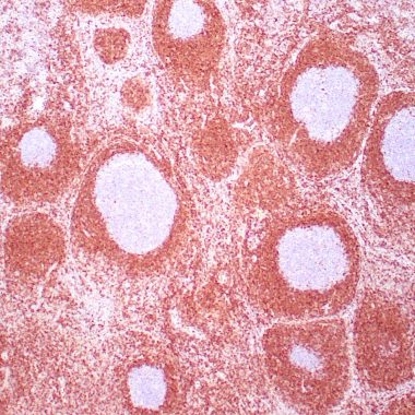 Anti-BCL2 antibody (41-54 aa) [124] IHC antibody paraffin tissue