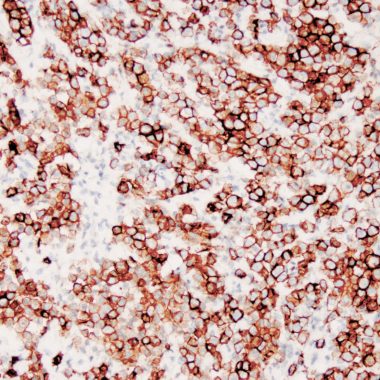 Anti-PDPN antibody [D2‐40] IHC antibody paraffin tissue