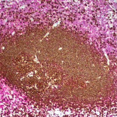 Anti-T/B cell cocktail antibody (23-119) [CD3 (ZR414) + CD20 (L26)] IHC antibody paraffin tissue