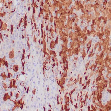 Anti-S-100 antibody [4C4.9] IHC antibody paraffin tissue
