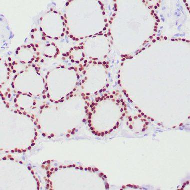 Anti-PAX8 antibody (C-Term) [ZR1] IHC antibody paraffin tissue