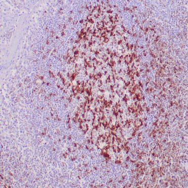 Anti-Recombinant-PDCD1 antibody (1-200aa) [ZM357] IHC antibody paraffin tissue